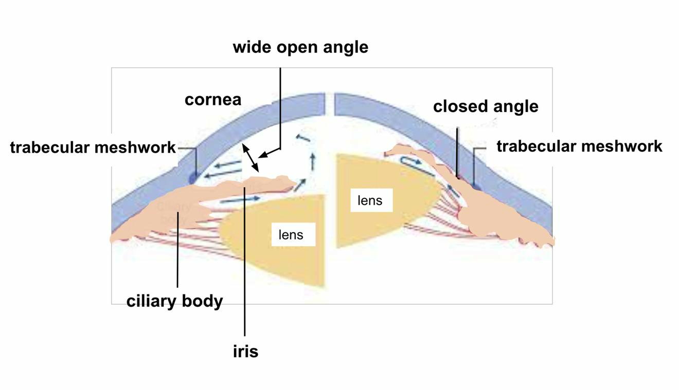 Schematic drawing of the anteriro chamber angle
